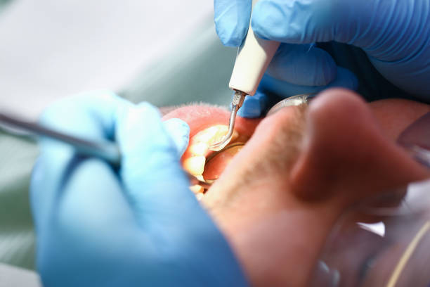 Best Emergency Cosmetic Dentistry (e.g., broken veneers) in Mason, OH